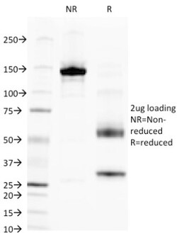 Alkaline Phosphatase, Tissue Non-Specific Antibody (V17.1), Novus Biologicals